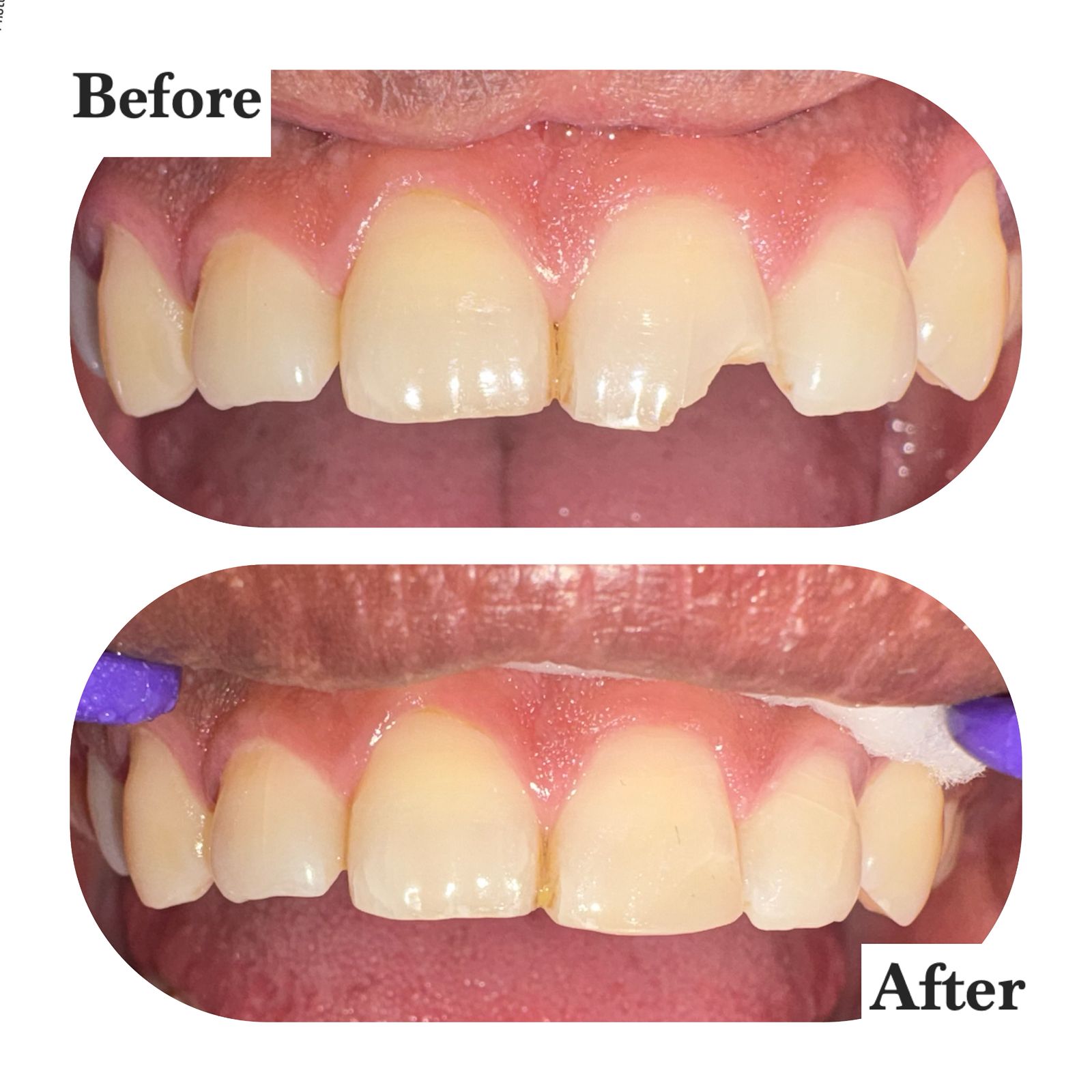 Home Aesthetic Restorations