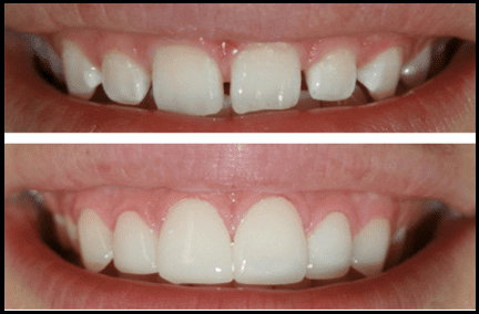 Home Smile Designing